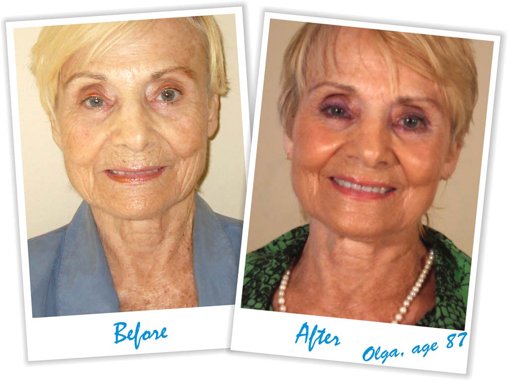 Life Cell Before and After Case Study